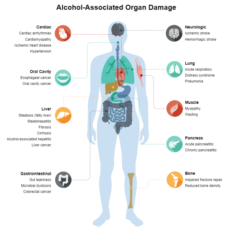 Alchocol associated organ damage