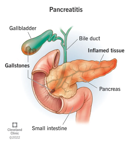 Small intestine